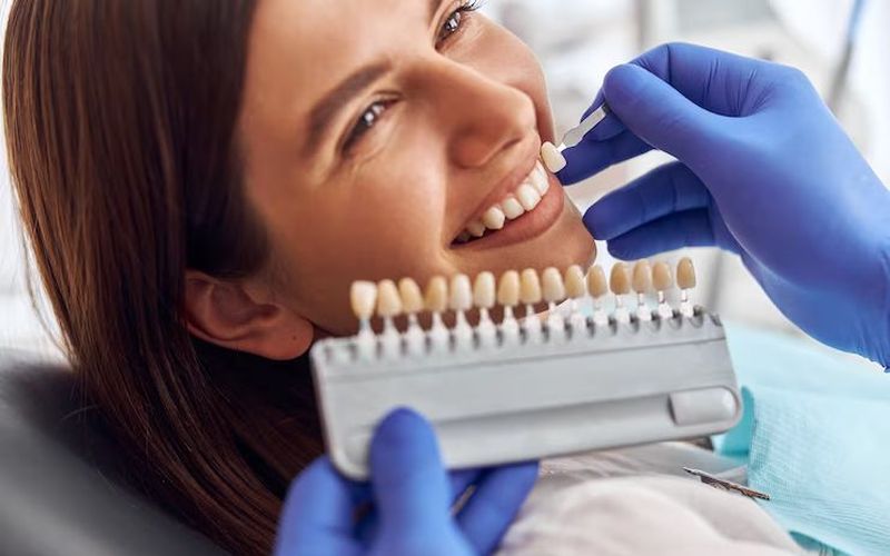 Shade matching for porcelain veneers at Ark Dental Global, Greater Kailash
