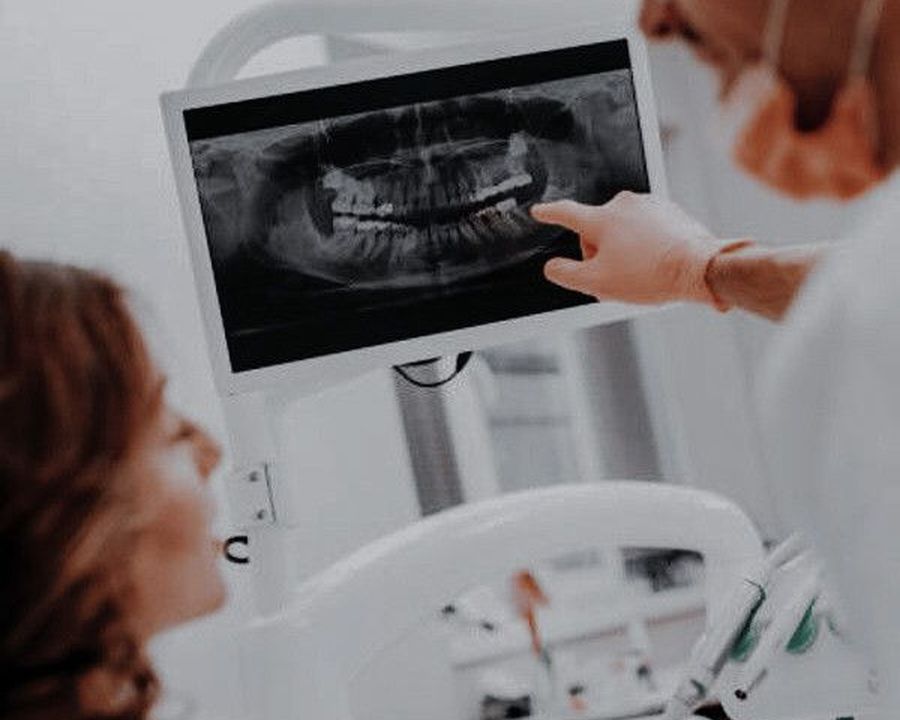 Dentist explaining a digital X-ray to a patient