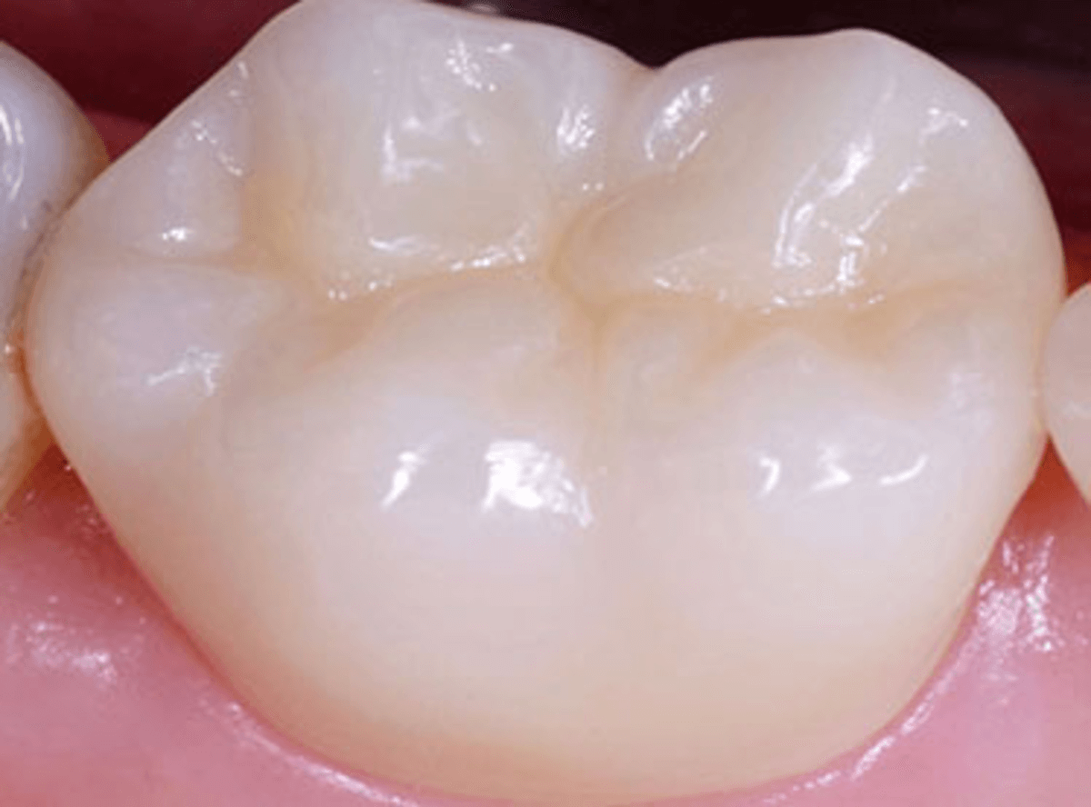 ark dental clinic, Best ark dental clinic in New Delhi, best dental clinic near me, best dental clinic in South Delhi, Best Dental Clinic in GK 1, best dental clinic in delhi, dental clinic in New delhi