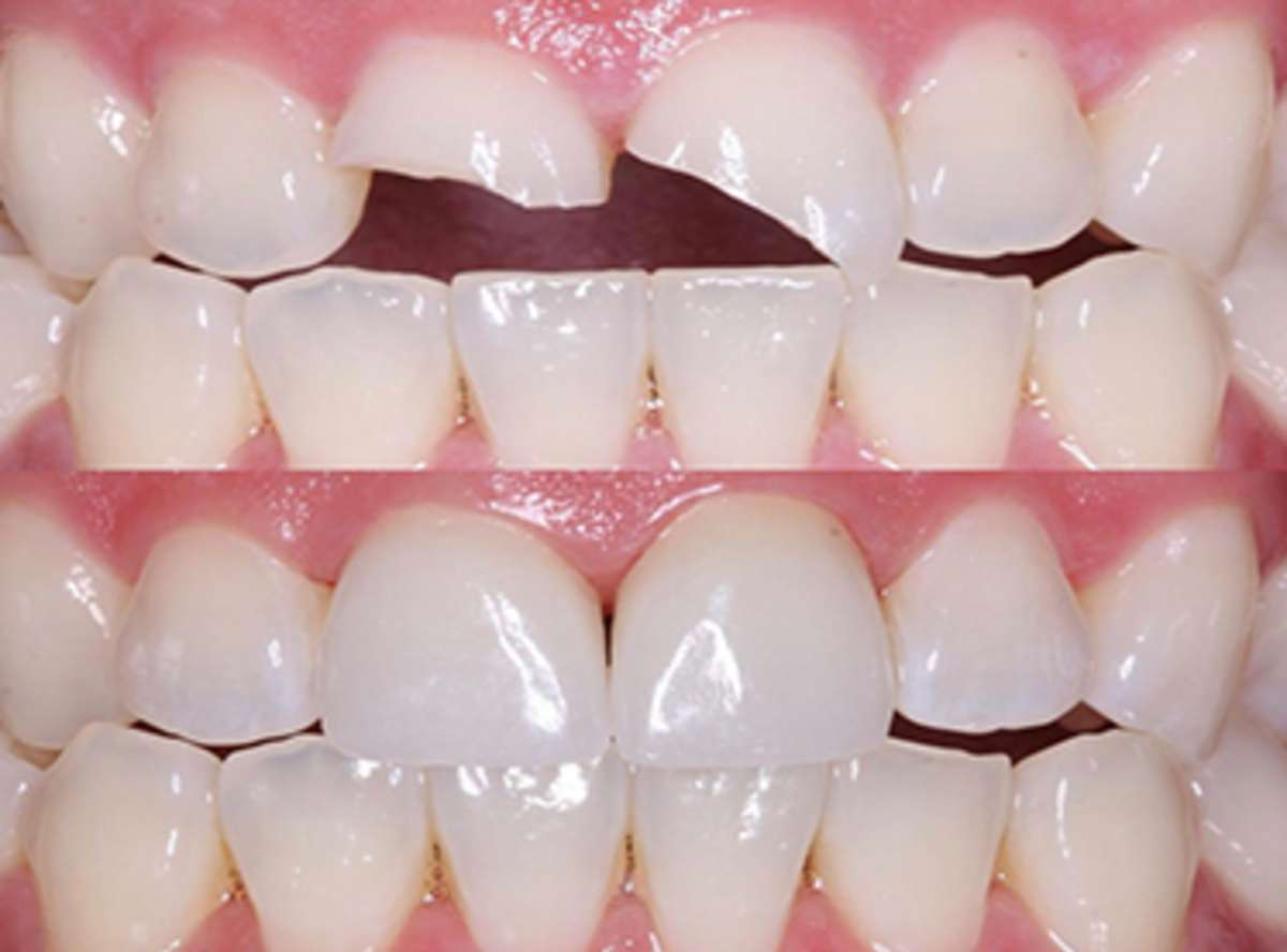ark dental clinic, Best ark dental clinic in New Delhi, best dental clinic near me, best dental clinic in South Delhi, Best Dental Clinic in GK 1, best dental clinic in delhi, dental clinic in New delhi
