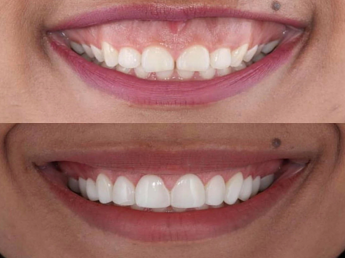 ark dental clinic, Best ark dental clinic in New Delhi, best dental clinic near me, best dental clinic in South Delhi, Best Dental Clinic in GK 1, best dental clinic in delhi, dental clinic in New delhi