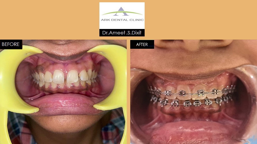 ark dental clinic, Best ark dental clinic in New Delhi, best dental clinic near me, best dental clinic in South Delhi, Best Dental Clinic in GK 1, best dental clinic in delhi, dental clinic in New delhi