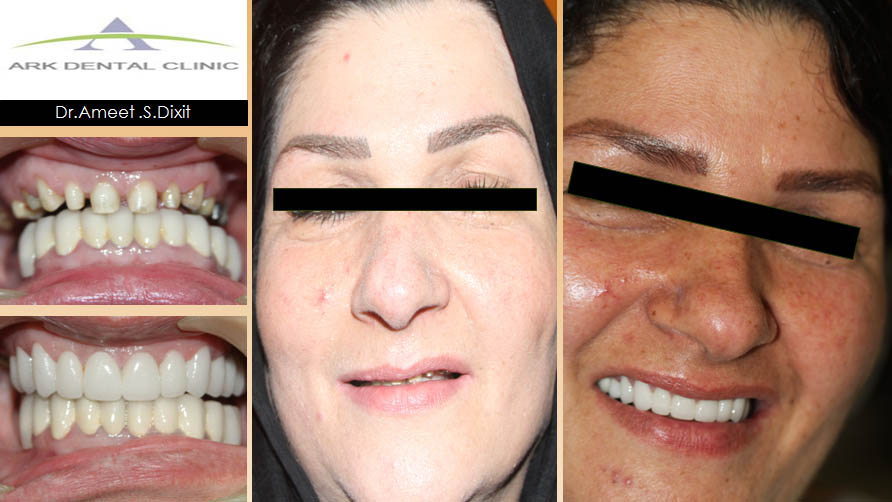 ark dental clinic, Best ark dental clinic in New Delhi, best dental clinic near me, best dental clinic in South Delhi, Best Dental Clinic in GK 1, best dental clinic in delhi, dental clinic in New delhi