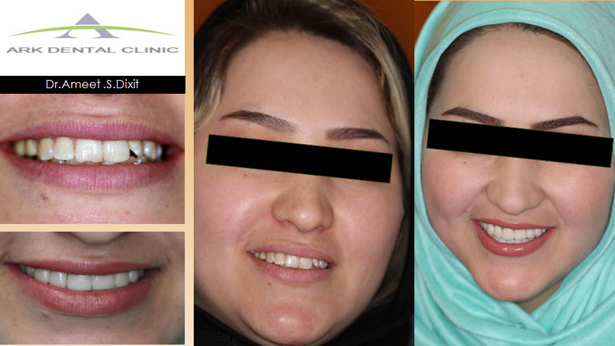 ark dental clinic, Best ark dental clinic in New Delhi, best dental clinic near me, best dental clinic in South Delhi, Best Dental Clinic in GK 1, best dental clinic in delhi, dental clinic in New delhi
