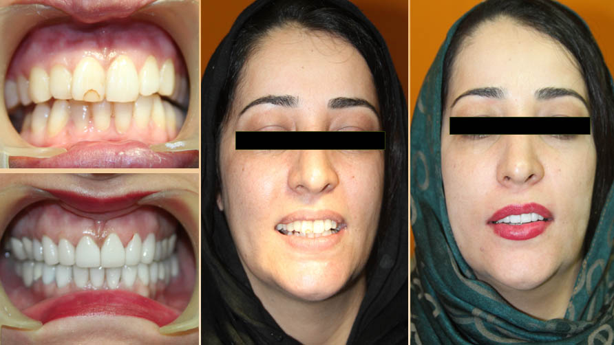 ark dental clinic, Best ark dental clinic in New Delhi, best dental clinic near me, best dental clinic in South Delhi, Best Dental Clinic in GK 1, best dental clinic in delhi, dental clinic in New delhi