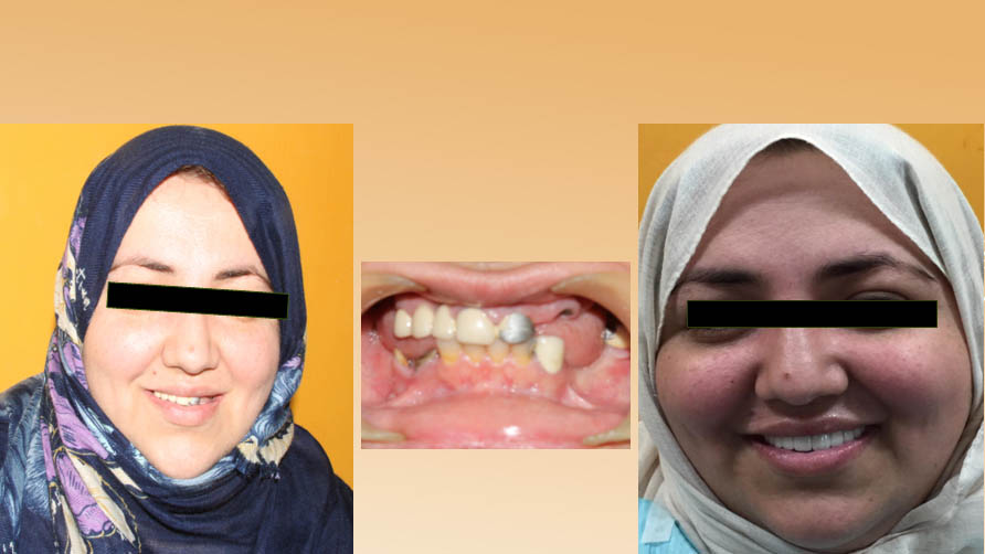 ark dental clinic, Best ark dental clinic in New Delhi, best dental clinic near me, best dental clinic in South Delhi, Best Dental Clinic in GK 1, best dental clinic in delhi, dental clinic in New delhi