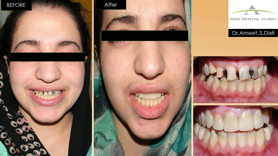 ark dental clinic, Best ark dental clinic in New Delhi, best dental clinic near me, best dental clinic in South Delhi, Best Dental Clinic in GK 1, best dental clinic in delhi, dental clinic in New delhi