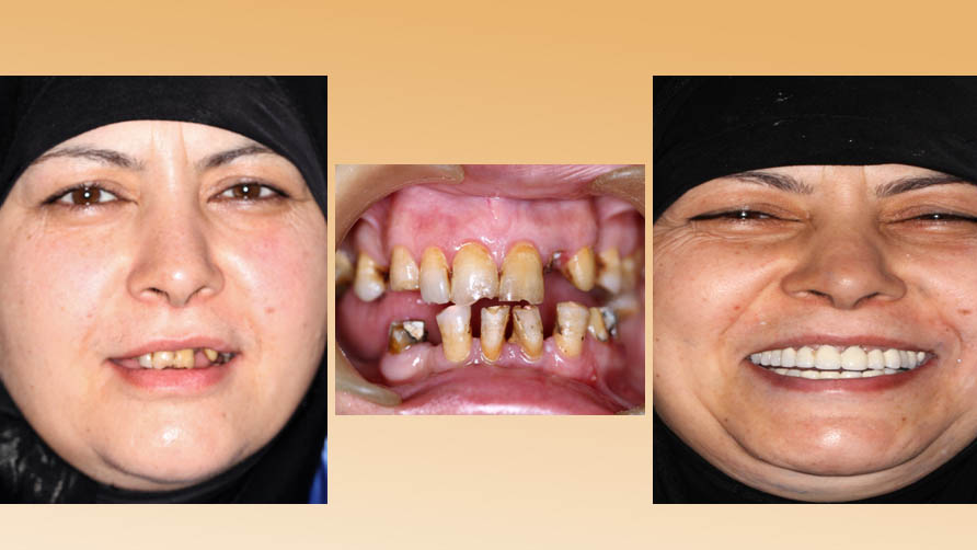 ark dental clinic, Best ark dental clinic in New Delhi, best dental clinic near me, best dental clinic in South Delhi, Best Dental Clinic in GK 1, best dental clinic in delhi, dental clinic in New delhi