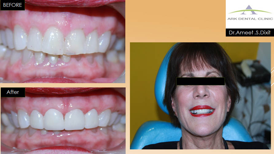 ark dental clinic, Best ark dental clinic in New Delhi, best dental clinic near me, best dental clinic in South Delhi, Best Dental Clinic in GK 1, best dental clinic in delhi, dental clinic in New delhi