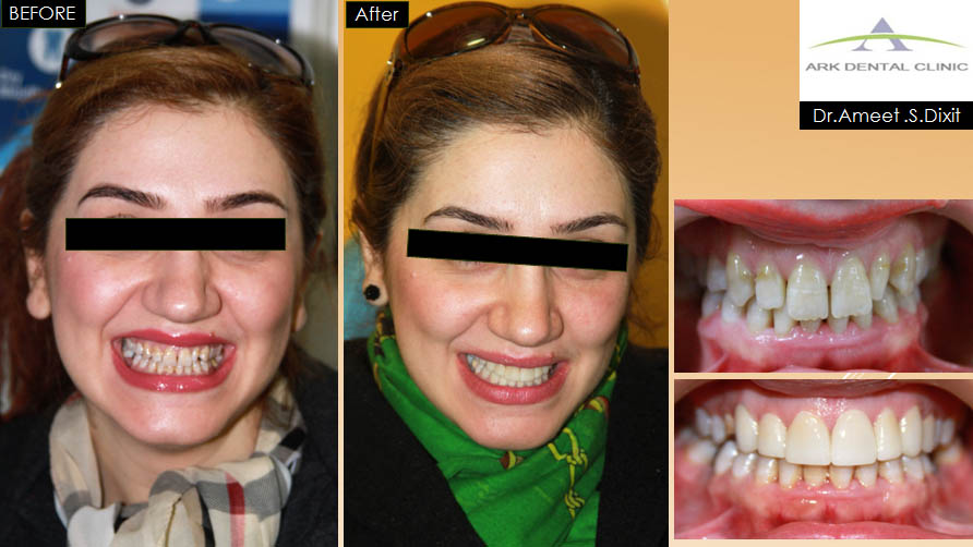 ark dental clinic, Best ark dental clinic in New Delhi, best dental clinic near me, best dental clinic in South Delhi, Best Dental Clinic in GK 1, best dental clinic in delhi, dental clinic in New delhi