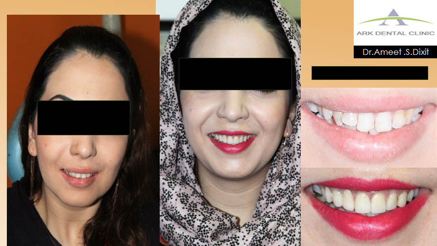 ark dental clinic, Best ark dental clinic in New Delhi, best dental clinic near me, best dental clinic in South Delhi, Best Dental Clinic in GK 1, best dental clinic in delhi, dental clinic in New delhi