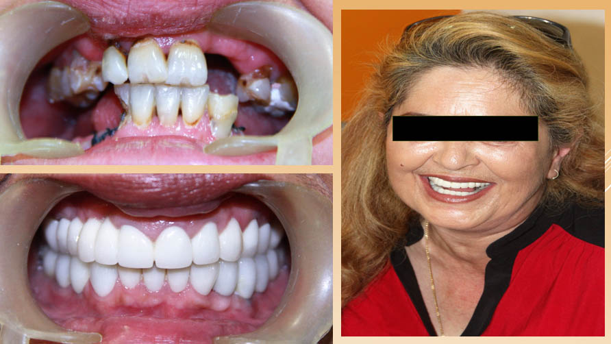 ark dental clinic, Best ark dental clinic in New Delhi, best dental clinic near me, best dental clinic in South Delhi, Best Dental Clinic in GK 1, best dental clinic in delhi, dental clinic in New delhi