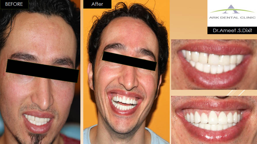 ark dental clinic, Best ark dental clinic in New Delhi, best dental clinic near me, best dental clinic in South Delhi, Best Dental Clinic in GK 1, best dental clinic in delhi, dental clinic in New delhi