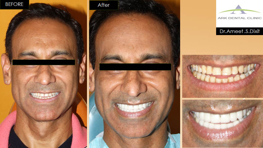 ark dental clinic, Best ark dental clinic in New Delhi, best dental clinic near me, best dental clinic in South Delhi, Best Dental Clinic in GK 1, best dental clinic in delhi, dental clinic in New delhi